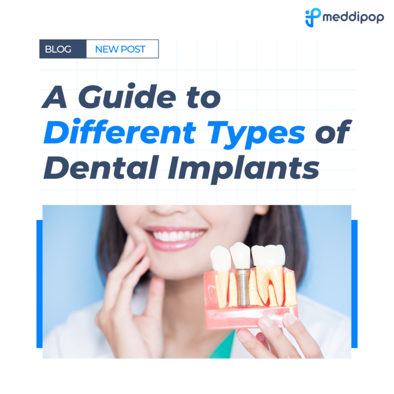 A Guide to Different Types of Dental Implants MeddiPop