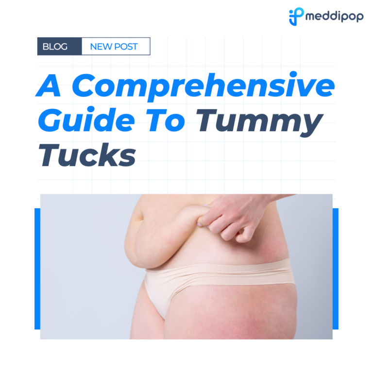 A Comprehensive Guide To Tummy Tucks Meddipop 